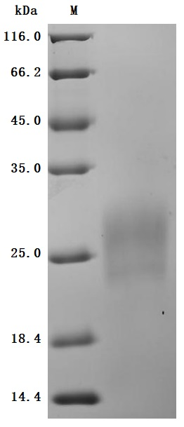 Recombinant Human Gastric inhibitory polypeptide receptor(GIPR), partial (Active)