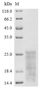 Recombinant Human Polyadenylate-binding protein-interacting protein 2 (PAIP2)