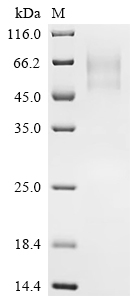 Recombinant Pig Interleukin-6 receptor subunit alpha (IL6R), partial