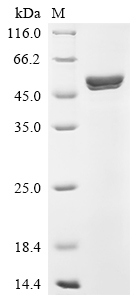 Recombinant Human Alpha-enolase (ENO1)