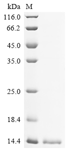 Recombinant Mouse Acyl-CoA-binding protein (Dbi)