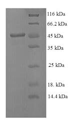 Recombinant Mouse Stromelysin-1 (Mmp3)