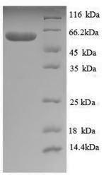 Recombinant Thermus aquaticus DNA polymerase I, thermostable (polA), partial