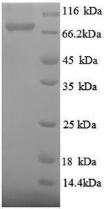 Recombinant Thermus aquaticus DNA polymerase I, thermostable (polA), partial