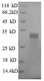 Recombinant Human Laminin subunit beta-2 (LAMB2), partial