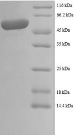 Recombinant Human LIM and SH3 domain protein 1 (LASP1), partial