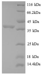 Recombinant Human 60S acidic ribosomal protein P2 (RPLP2), partial