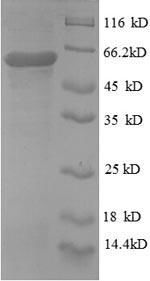 Recombinant Human Protein disulfide-isomerase (P4HB), partial