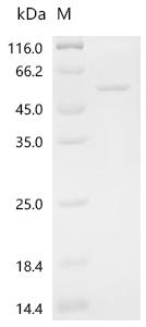 Recombinant Human Actin-related protein 3 (ACTR3)