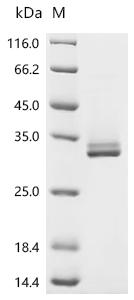 Recombinant Mouse Insulin-like growth factor-binding protein 1 (Igfbp1)