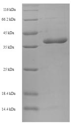 Human BCL2L11 protein