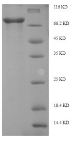 Human EIF2AK2 protein