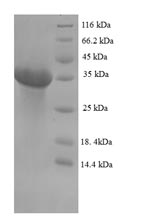 Bovine EPO protein