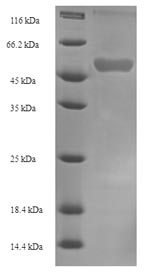 Human FDXR protein