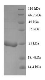 Viral KP6 killer toxin protein