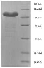 Protozoa PPDK protein