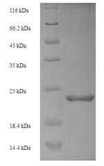 Zebrafish mt protein