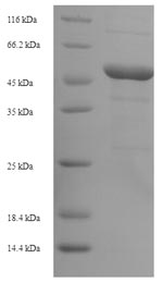 E. coli ompC protein