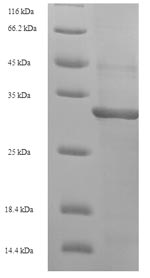 E. coli mutT protein