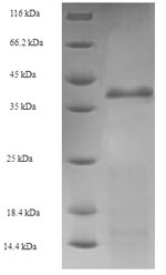 E. coli ruvA protein