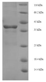 E. coli tetR protein