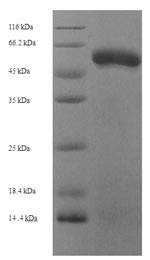 Human FGL2 protein