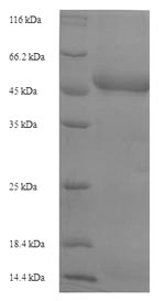 parasite Plasmepsin-1 protein