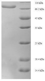 Human D2HGDH protein