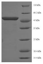 Mouse Psat1 protein