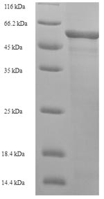 Human L2HGDH protein