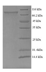 Human TCHP protein