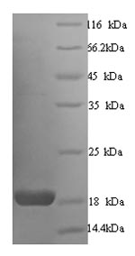 Human CALM1 protein
