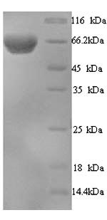 Human EIF2AK2 protein