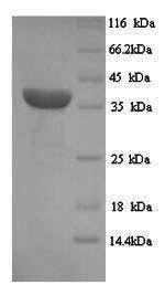 Human MAGEA1 protein