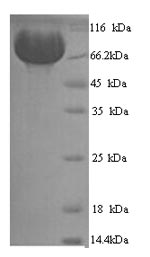Human MME protein