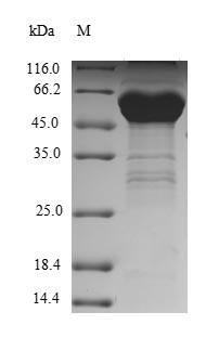 Human SMARCA4 protein