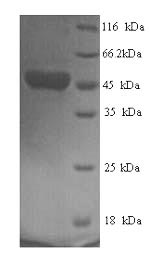 Human Fusion glycoprotein F0 protein
