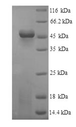 Human FGL2 protein