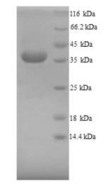 Mouse Arg1 protein