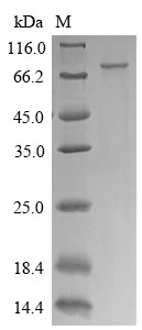 Human CTPS1 protein