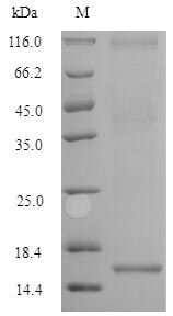 Human ACVR2B protein