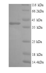 Human IL6R protein