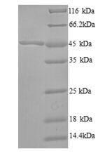 Bacterial fabF protein
