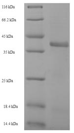 Bacterial fabI protein