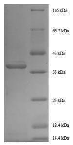 Human GDF11 protein