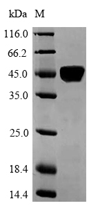Human LAMA5 protein