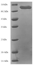 Human MAPKAP1 protein