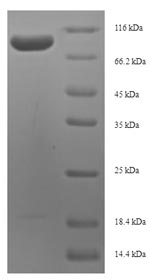 Human MKI67 protein