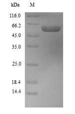 Mouse Aldh1a1 protein