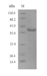 Human OGG1 protein